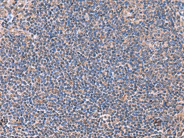 PEPD Polyclonal Antibody - image 1