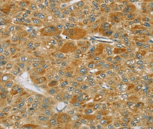 TP53I11 Polyclonal Antibody - image 1
