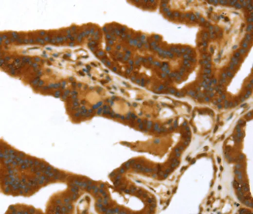 TP53I11 Polyclonal Antibody - image 2