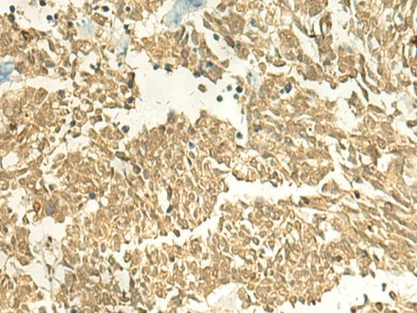 EEF1AKMT2 Polyclonal Antibody - image 1