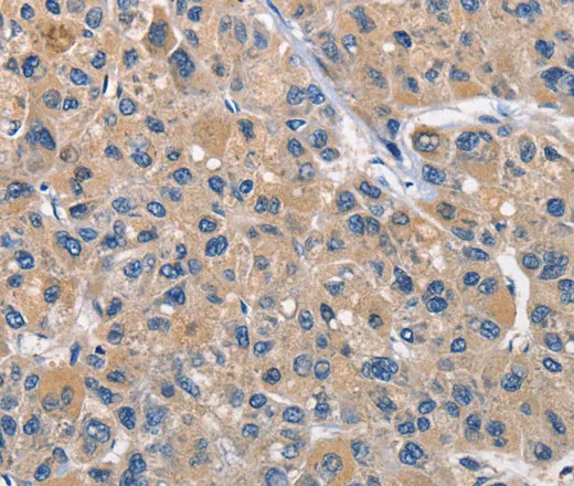 CLEC2D Polyclonal Antibody - image 1