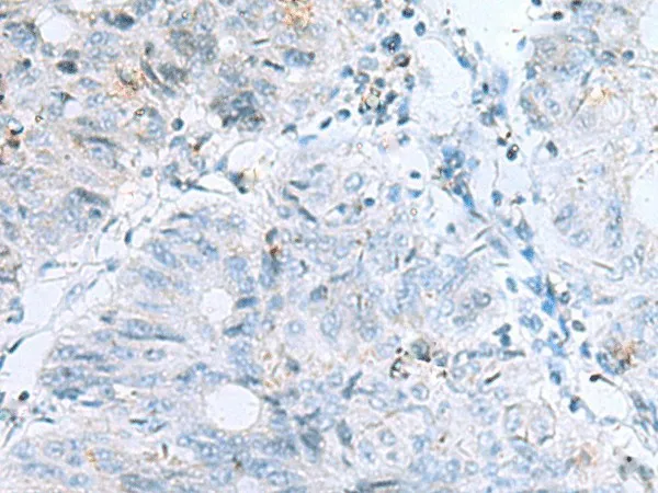 POMC Polyclonal Antibody - image 1