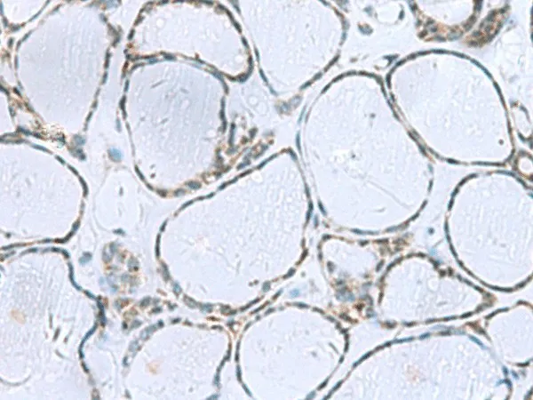 POMC Polyclonal Antibody - image 2