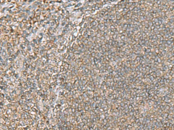 ARF5 Polyclonal Antibody - image 1