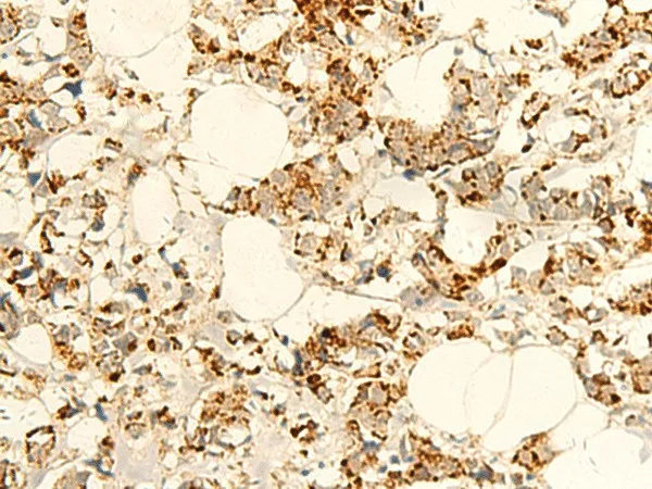 NAPRT Polyclonal Antibody - image 1