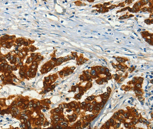 ADCY3 Polyclonal Antibody - image 1