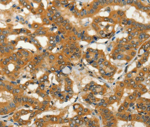 ADCY3 Polyclonal Antibody - image 2