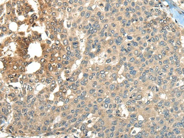 MAPK4 Polyclonal Antibody - image 1