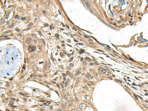 MAPK4 Polyclonal Antibody - image 2