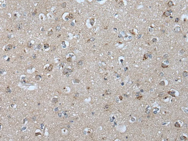 VPS35 Polyclonal Antibody - image 1