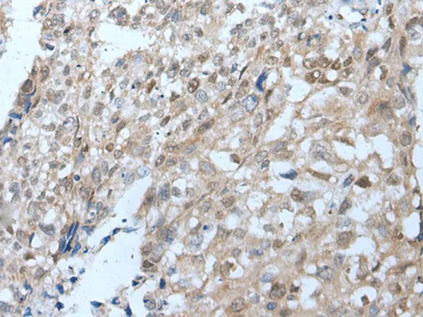 VPS35 Polyclonal Antibody - image 2