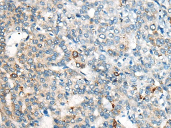CES2 Polyclonal Antibody - image 1