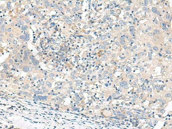 GART Polyclonal Antibody - image 1