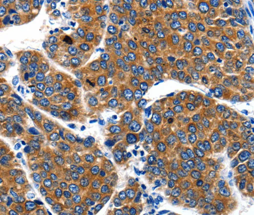 IGF2BP1 Polyclonal Antibody - image 1