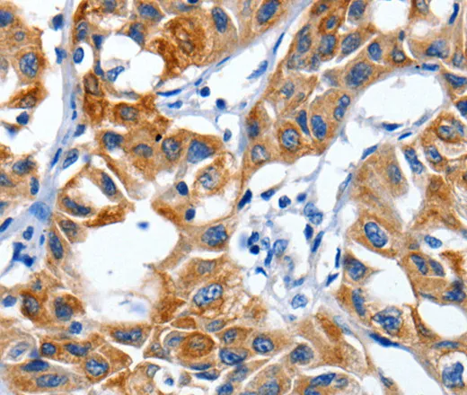 IGF2BP1 Polyclonal Antibody - image 2