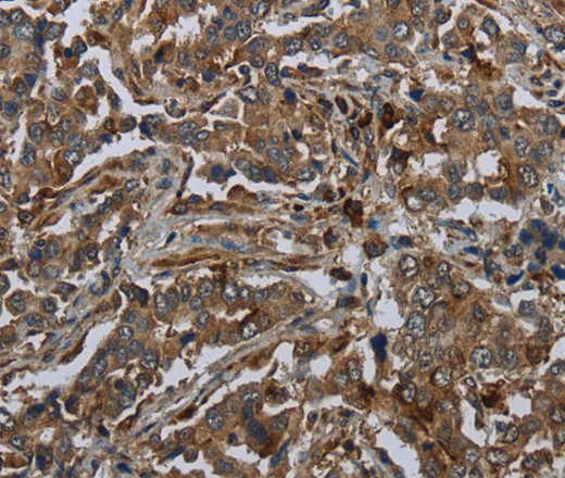 GLUL Polyclonal Antibody - image 1