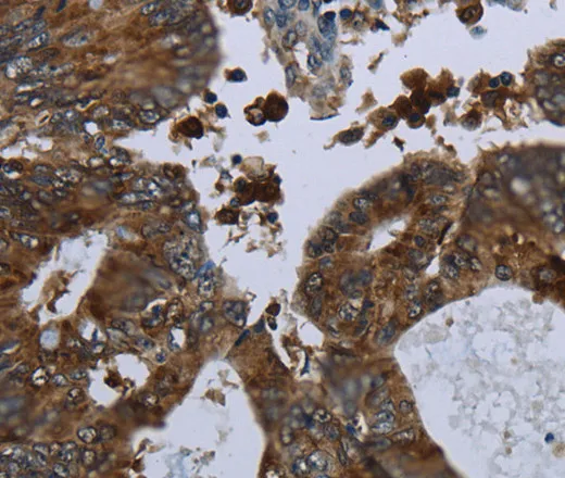 GLUL Polyclonal Antibody - image 2