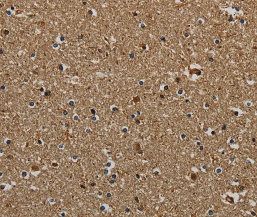KLK6 Polyclonal Antibody - image 1