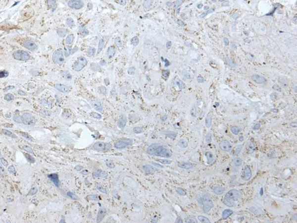RASA1 Polyclonal Antibody - image 1