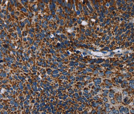IDH2 Polyclonal Antibody - image 1