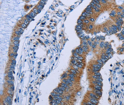 IDH2 Polyclonal Antibody - image 2