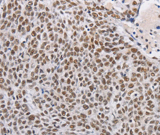 THOC7 Polyclonal Antibody - image 1