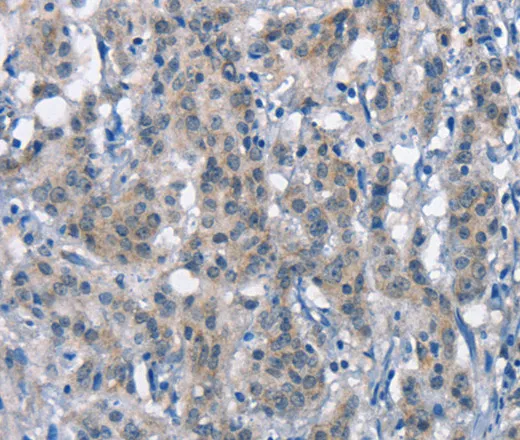 CD226 Polyclonal Antibody - image 1
