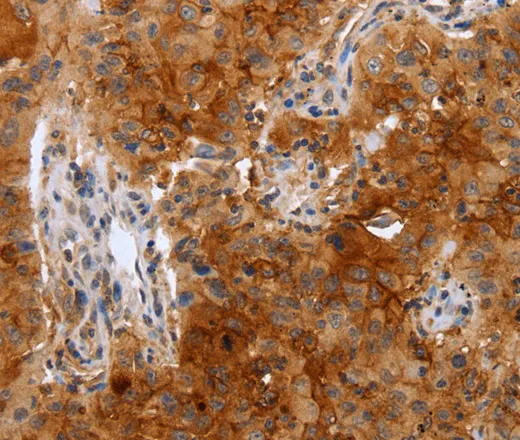 PLAUR Polyclonal Antibody - image 1