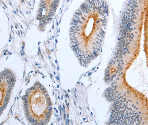 PLAUR Polyclonal Antibody - image 2
