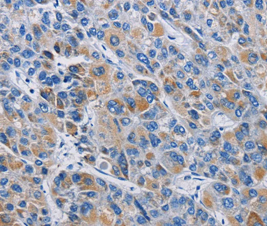 RICTOR Polyclonal Antibody - image 1