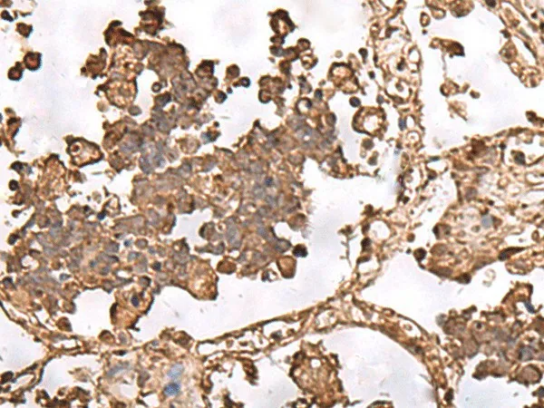 FAAP24 Polyclonal Antibody - image 1