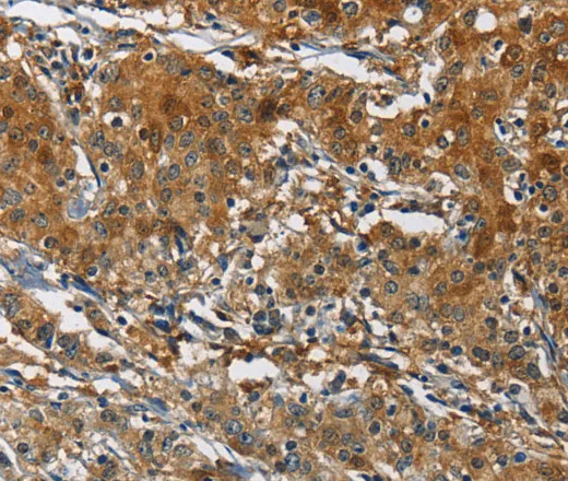 CAST Polyclonal Antibody - image 1
