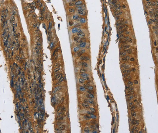 CAST Polyclonal Antibody - image 2