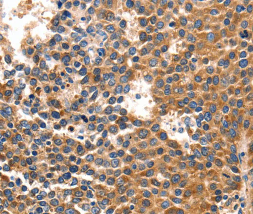 IRF1 Polyclonal Antibody - image 1