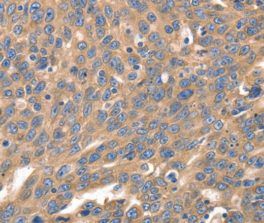 IRF1 Polyclonal Antibody - image 2