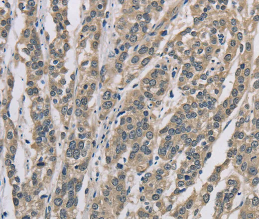 DSG2 Polyclonal Antibody - image 1