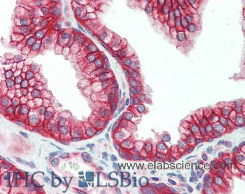 DSG2 Polyclonal Antibody - image 3