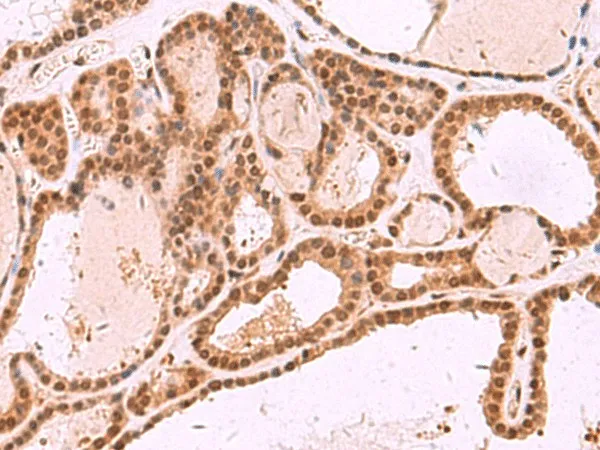 MCMBP Polyclonal Antibody - image 1