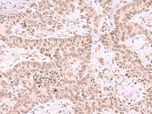 MCMBP Polyclonal Antibody - image 2