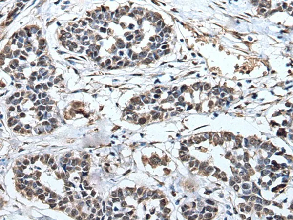 PRUNE Polyclonal Antibody - image 1