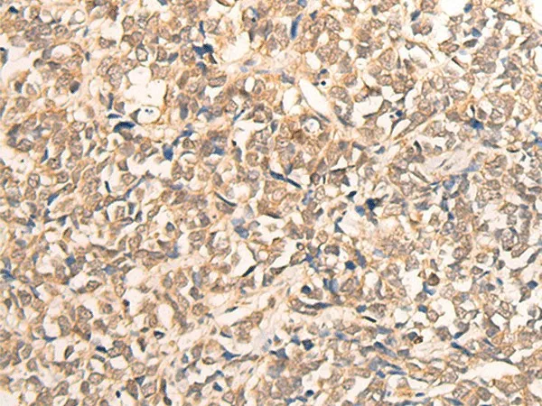 CPS1 Polyclonal Antibody - image 1