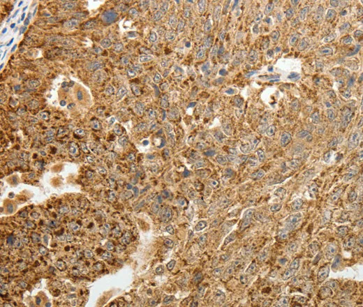 TFF2 Polyclonal Antibody - image 1