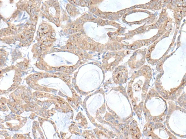 PLGLB2 Polyclonal Antibody - image 1