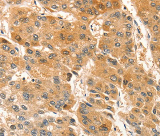 APTX Polyclonal Antibody - image 1