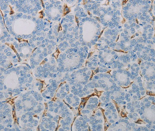 CD31 Polyclonal Antibody - image 1