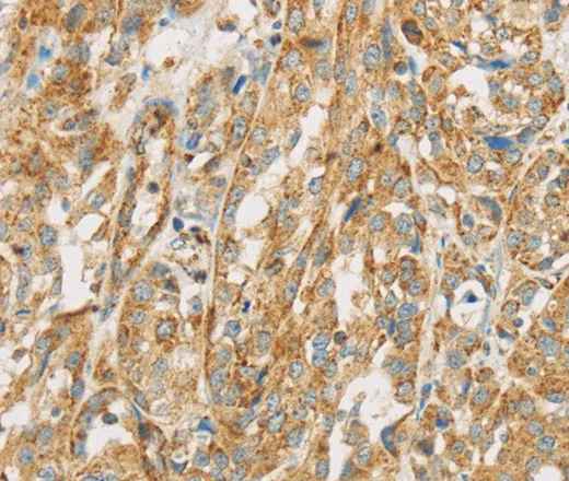 NPPB Polyclonal Antibody - image 1