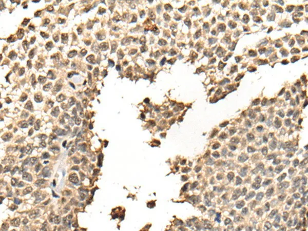 BATF Polyclonal Antibody - image 1