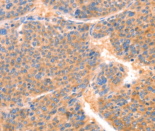 PRDX2 Polyclonal Antibody - image 1
