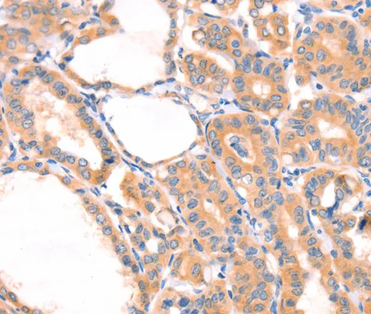 PRDX2 Polyclonal Antibody - image 2