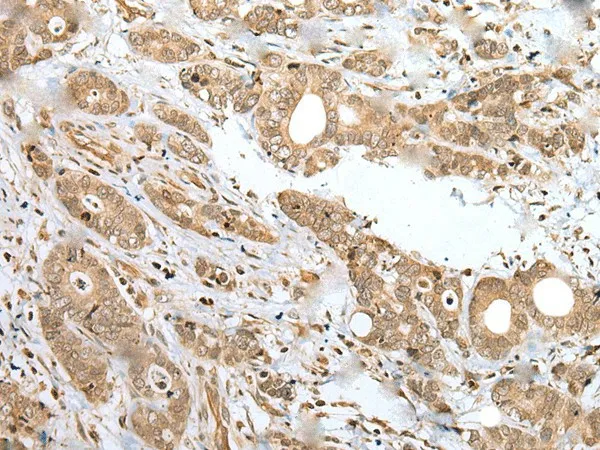 SPCS2 Polyclonal Antibody - image 1